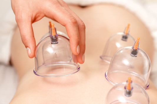 Cupping Therapy for Frozen Shoulder